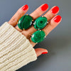 Malachite oval cabochon ring